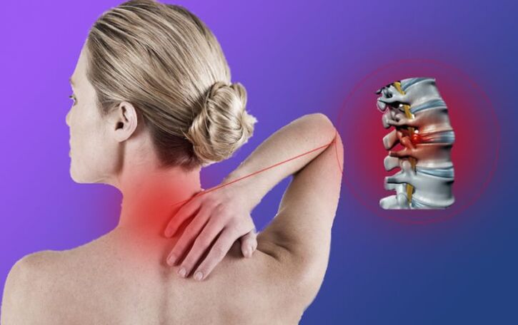 Entzündung der Wirbelsäule mit zervikaler Osteochondrose