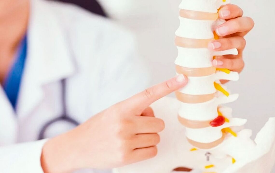 Schädigung der Wirbelsäule durch zervikale Osteochondrose