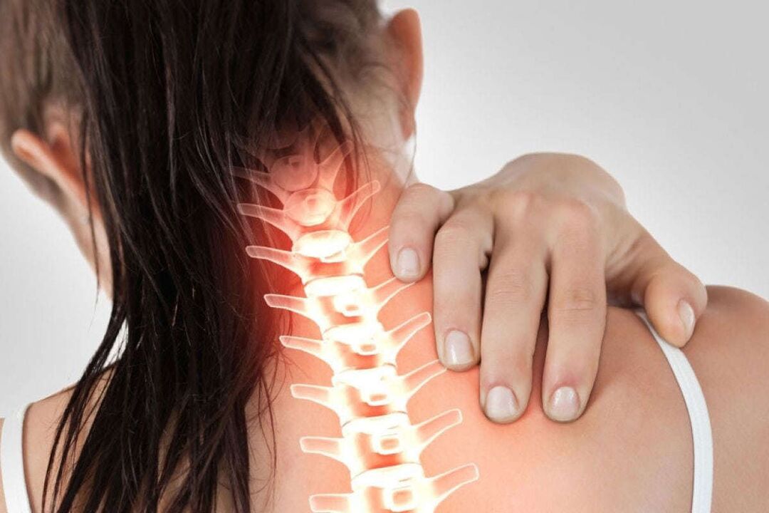Manifestationen der zervikalen Osteochondrose